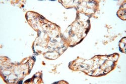 TEX14 Rabbit anti-Human, Mouse, Polyclonal, Proteintech 150 &mu;L | Buy Online | Proteintech Group Inc | Fisher Scientific