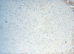 TEX14 Rabbit anti-Human, Mouse, Polyclonal, Proteintech 150 &mu;L | Buy Online | Proteintech Group Inc | Fisher Scientific