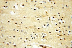 TEX14 Rabbit anti-Human, Mouse, Polyclonal, Proteintech 150 &mu;L | Buy Online | Proteintech Group Inc | Fisher Scientific
