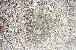 TEX14 Rabbit anti-Human, Mouse, Polyclonal, Proteintech 150 &mu;L | Buy Online | Proteintech Group Inc | Fisher Scientific