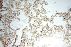 TEX14 Rabbit anti-Human, Mouse, Polyclonal, Proteintech 150 &mu;L | Buy Online | Proteintech Group Inc | Fisher Scientific