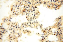 TEX14 Rabbit anti-Human, Mouse, Polyclonal, Proteintech 150 &mu;L | Buy Online | Proteintech Group Inc | Fisher Scientific