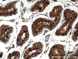 TEX14 Rabbit anti-Human, Mouse, Polyclonal, Proteintech 150 &mu;L | Buy Online | Proteintech Group Inc | Fisher Scientific