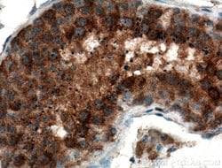 TEX14 Rabbit anti-Human, Mouse, Polyclonal, Proteintech 150 &mu;L | Buy Online | Proteintech Group Inc | Fisher Scientific