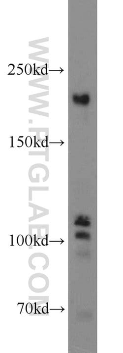 TEX14 Rabbit anti-Human, Mouse, Polyclonal, Proteintech 150 &mu;L | Buy Online | Proteintech Group Inc | Fisher Scientific
