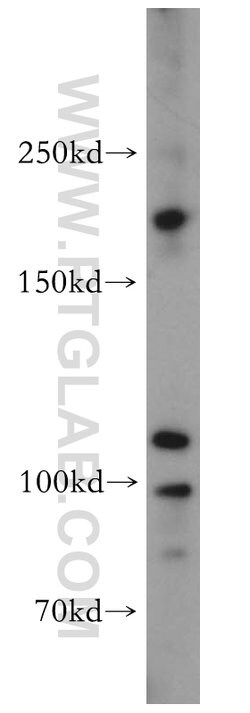 TEX14 Rabbit anti-Human, Mouse, Polyclonal, Proteintech 150 &mu;L | Buy Online | Proteintech Group Inc | Fisher Scientific