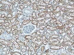 HNRNPL Rabbit anti-Human, Mouse, Rat, Polyclonal, Proteintech 150 &mu;L;