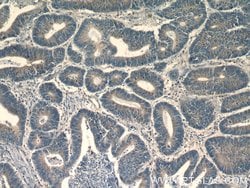 HNRNPL Rabbit anti-Human, Mouse, Rat, Polyclonal, Proteintech 150 &mu;L;