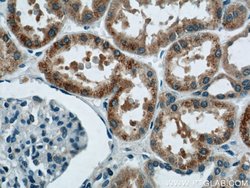 HNRNPL Rabbit anti-Human, Mouse, Rat, Polyclonal, Proteintech 150 &mu;L;