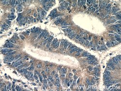 HNRNPL Rabbit anti-Human, Mouse, Rat, Polyclonal, Proteintech 150 &mu;L;