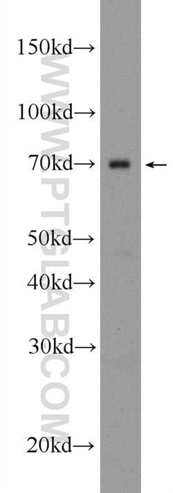 HNRNPL Rabbit anti-Human, Mouse, Rat, Polyclonal, Proteintech 150 &mu;L;