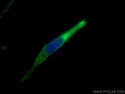 ANGPTL4 Rabbit anti-Human, Mouse, Polyclonal, Proteintech:Antibodies:Primary
