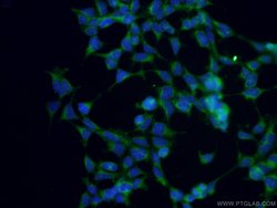 ANGPTL4 Rabbit anti-Human, Mouse, Polyclonal, Proteintech:Antibodies:Primary