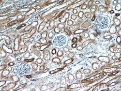 ANGPTL4 Rabbit anti-Human, Mouse, Polyclonal, Proteintech:Antibodies:Primary