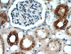 ANGPTL4 Rabbit anti-Human, Mouse, Polyclonal, Proteintech:Antibodies:Primary