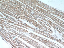 ANGPTL4 Rabbit anti-Human, Mouse, Polyclonal, Proteintech:Antibodies:Primary