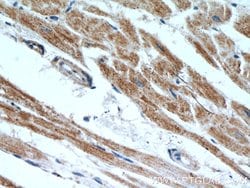 ANGPTL4 Rabbit anti-Human, Mouse, Polyclonal, Proteintech:Antibodies:Primary