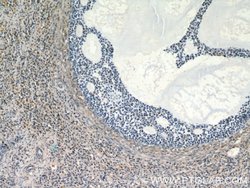 ANGPTL4 Rabbit anti-Human, Mouse, Polyclonal, Proteintech:Antibodies:Primary