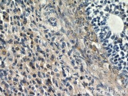 ANGPTL4 Rabbit anti-Human, Mouse, Polyclonal, Proteintech:Antibodies:Primary