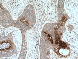 ANGPTL4 Rabbit anti-Human, Mouse, Polyclonal, Proteintech:Antibodies:Primary