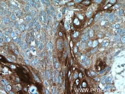 ANGPTL4 Rabbit anti-Human, Mouse, Polyclonal, Proteintech:Antibodies:Primary