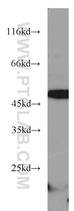 ANGPTL4 Rabbit anti-Human, Mouse, Polyclonal, Proteintech:Antibodies:Primary