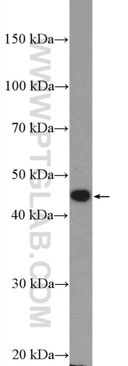 ANGPTL4 Rabbit anti-Human, Mouse, Polyclonal, Proteintech:Antibodies:Primary