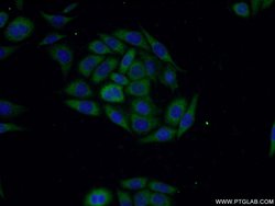 SLN Rabbit anti-Human, Mouse, Rat, Polyclonal, Proteintech 150 &mu;L; Unconjugated:Antibodies,