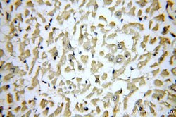 SLN Rabbit anti-Human, Mouse, Rat, Polyclonal, Proteintech 150 &mu;L; Unconjugated:Antibodies,