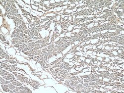 SLN Rabbit anti-Human, Mouse, Rat, Polyclonal, Proteintech 150 &mu;L; Unconjugated:Antibodies,