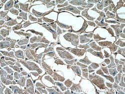 SLN Rabbit anti-Human, Mouse, Rat, Polyclonal, Proteintech 150 &mu;L; Unconjugated:Antibodies,