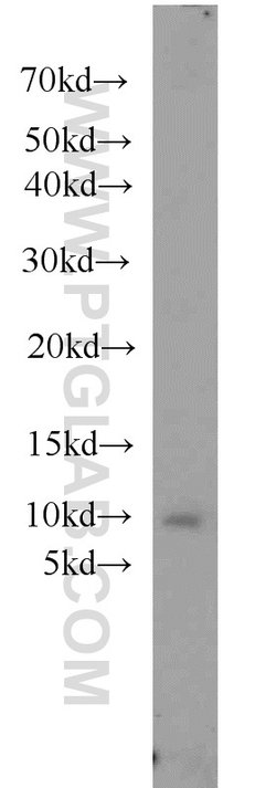 SLN Rabbit anti-Human, Mouse, Rat, Polyclonal, Proteintech 150 &mu;L; Unconjugated:Antibodies,