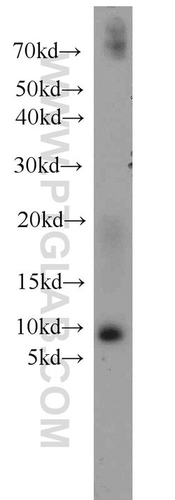 SLN Rabbit anti-Human, Mouse, Rat, Polyclonal, Proteintech 150 &mu;L; Unconjugated:Antibodies,