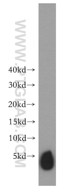 SLN Rabbit anti-Human, Mouse, Rat, Polyclonal, Proteintech 150 &mu;L; Unconjugated:Antibodies,