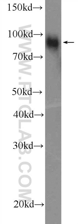 FURIN Rabbit anti-Human, Mouse, Rat, Polyclonal, Proteintech:Antibodies:Primary