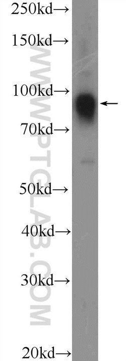 FURIN Rabbit anti-Human, Mouse, Rat, Polyclonal, Proteintech:Antibodies:Primary