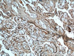 FURIN Rabbit anti-Human, Mouse, Rat, Polyclonal, Proteintech:Antibodies:Primary