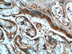 FURIN Rabbit anti-Human, Mouse, Rat, Polyclonal, Proteintech:Antibodies:Primary