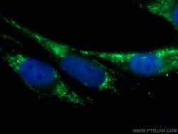 Calsequestrin 2 Rabbit anti-Human, Mouse, Rat, Polyclonal, Proteintech 150 &mu;L | Buy Online | Proteintech Group Inc | Fisher Scientific