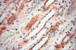 Calsequestrin 2 Rabbit anti-Human, Mouse, Rat, Polyclonal, Proteintech 150 &mu;L | Buy Online | Proteintech Group Inc | Fisher Scientific