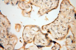 Calsequestrin 2 Rabbit anti-Human, Mouse, Rat, Polyclonal, Proteintech 150 &mu;L | Buy Online | Proteintech Group Inc | Fisher Scientific