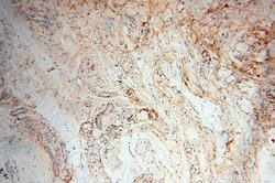 Calsequestrin 2 Rabbit anti-Human, Mouse, Rat, Polyclonal, Proteintech 150 &mu;L | Buy Online | Proteintech Group Inc | Fisher Scientific