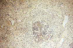 Calsequestrin 2 Rabbit anti-Human, Mouse, Rat, Polyclonal, Proteintech 150 &mu;L | Buy Online | Proteintech Group Inc | Fisher Scientific
