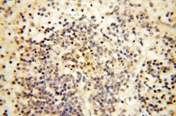 Calsequestrin 2 Rabbit anti-Human, Mouse, Rat, Polyclonal, Proteintech 150 &mu;L | Buy Online | Proteintech Group Inc | Fisher Scientific