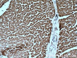 Calsequestrin 2 Rabbit anti-Human, Mouse, Rat, Polyclonal, Proteintech 150 &mu;L | Buy Online | Proteintech Group Inc | Fisher Scientific