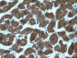 Calsequestrin 2 Rabbit anti-Human, Mouse, Rat, Polyclonal, Proteintech 150 &mu;L | Buy Online | Proteintech Group Inc | Fisher Scientific