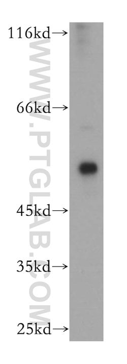 Calsequestrin 2 Rabbit anti-Human, Mouse, Rat, Polyclonal, Proteintech 150 &mu;L | Buy Online | Proteintech Group Inc | Fisher Scientific