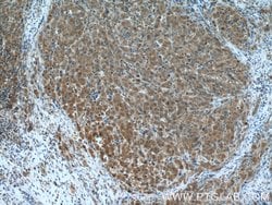 PRMT5 Rabbit anti-Human, Mouse, Polyclonal, Proteintech 150 &mu;L; Unconjugated:Antibodies,