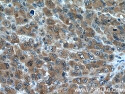 PRMT5 Rabbit anti-Human, Mouse, Polyclonal, Proteintech 150 &mu;L; Unconjugated:Antibodies,