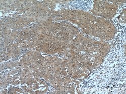 PRMT5 Rabbit anti-Human, Mouse, Polyclonal, Proteintech 150 &mu;L; Unconjugated:Antibodies,